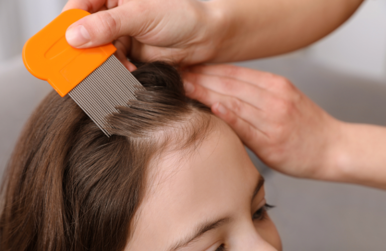 Home Remedies for Lice Infection: Natural Solutions to Banish the Bugs